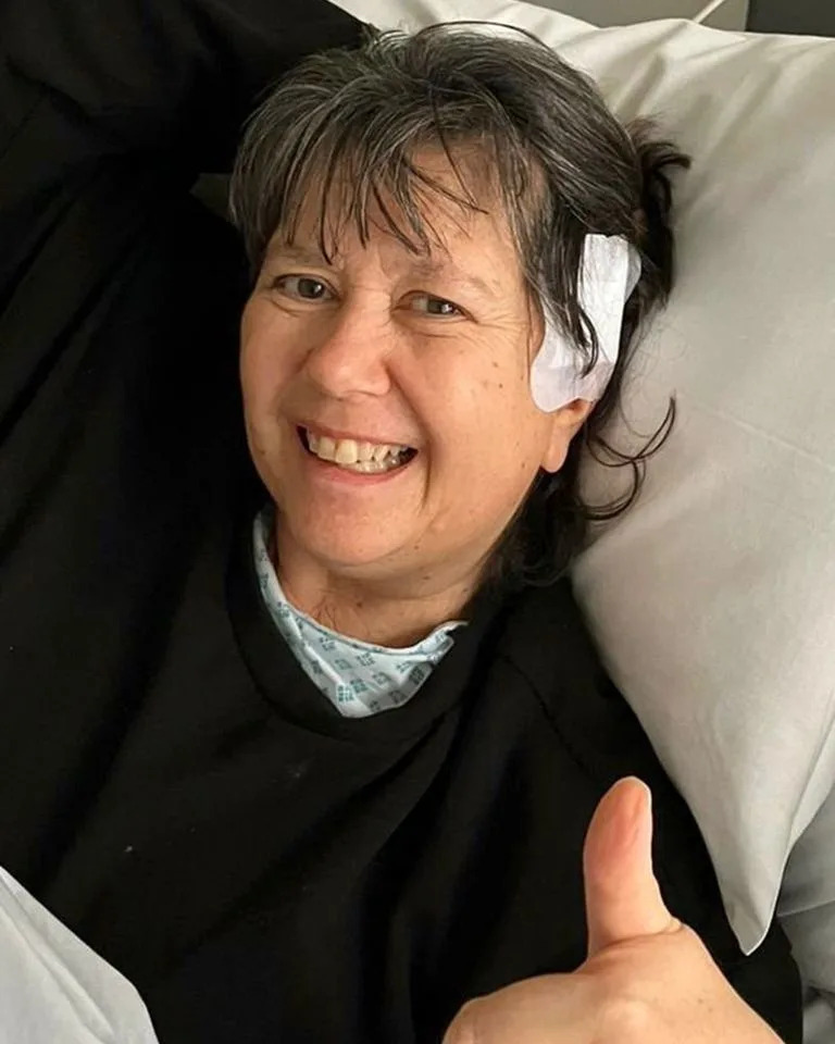 Michelle Dilger after surgeryCredit: swns