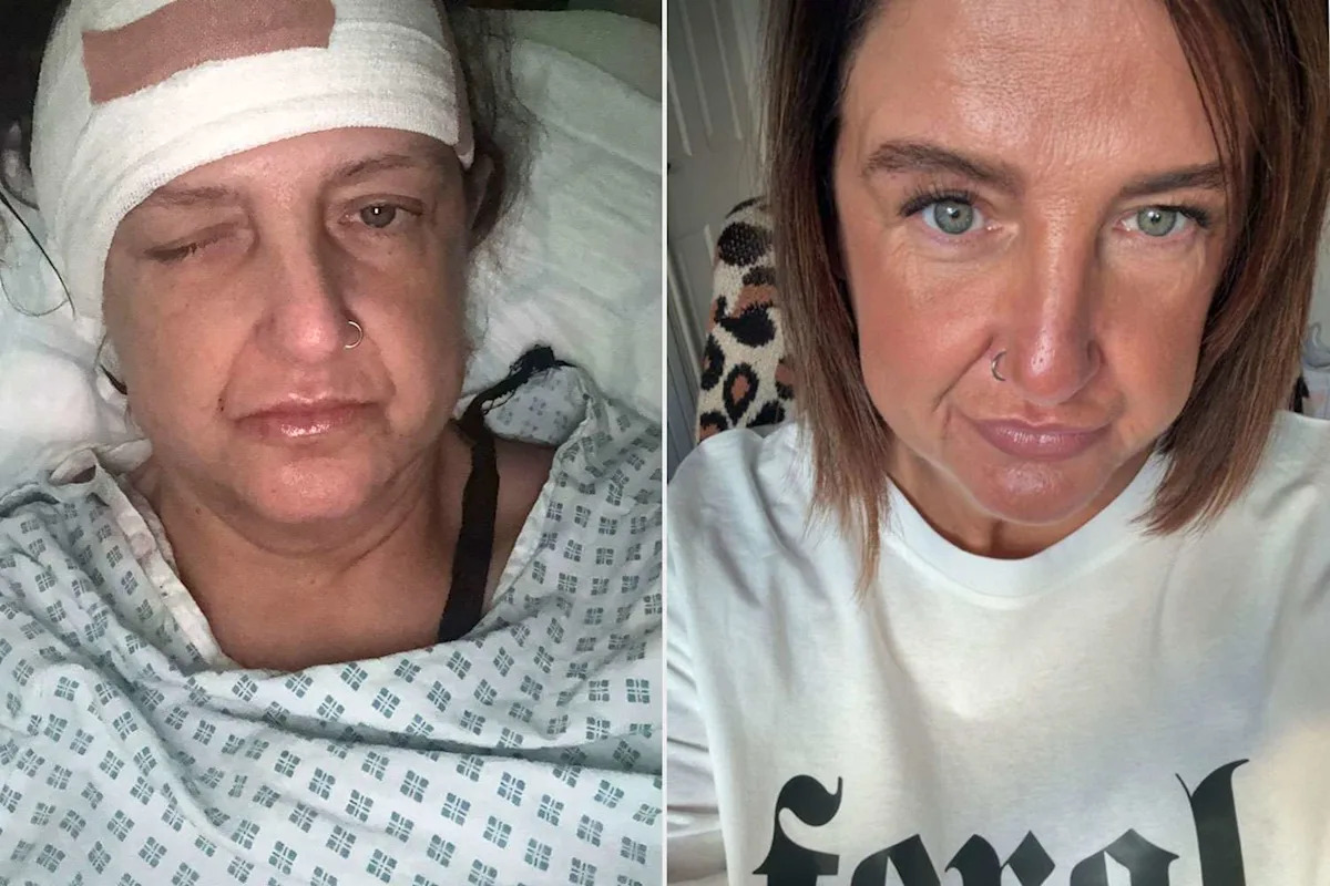 Docs Tell Woman to Take Painkillers for a Cold. After She's Found 'Barely Breathing,' She's Diagnosed with Meningitis