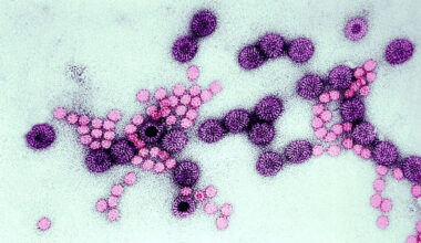 The Bay Area towns hit hardest by a highly contagious diarrheal illness