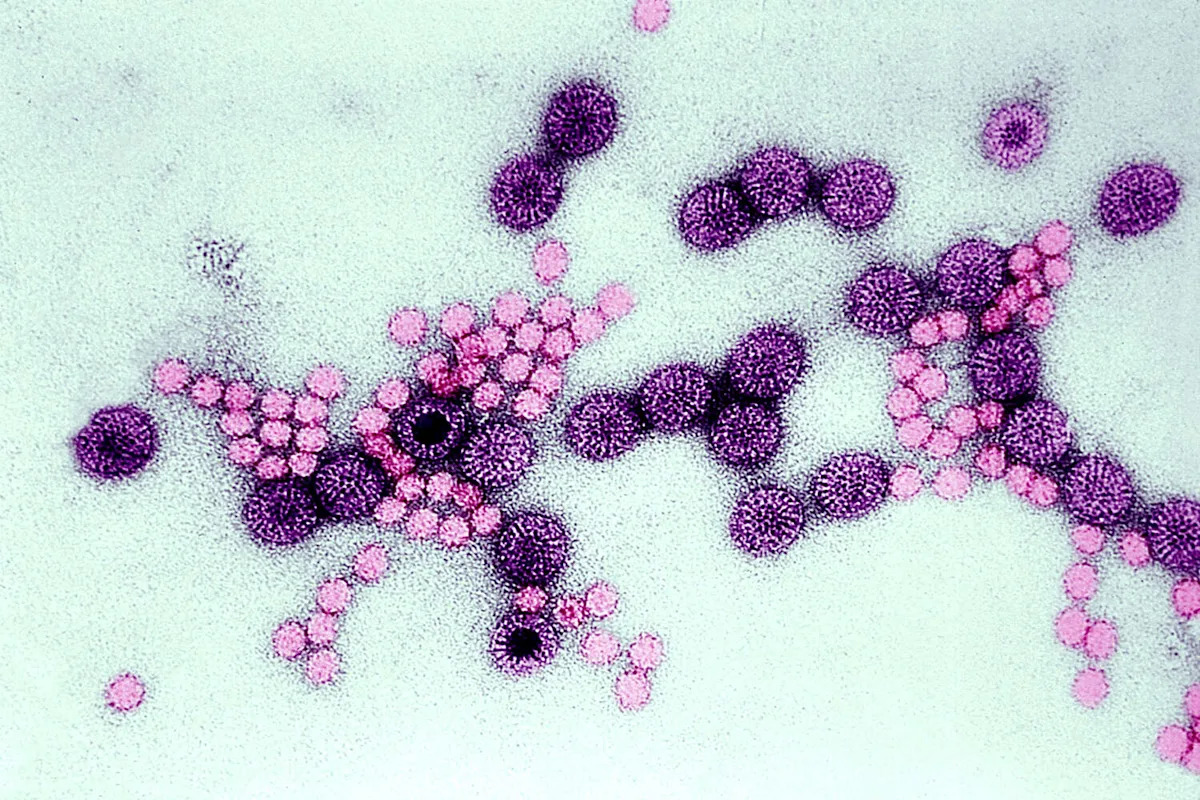 The Bay Area towns hit hardest by a highly contagious diarrheal illness
