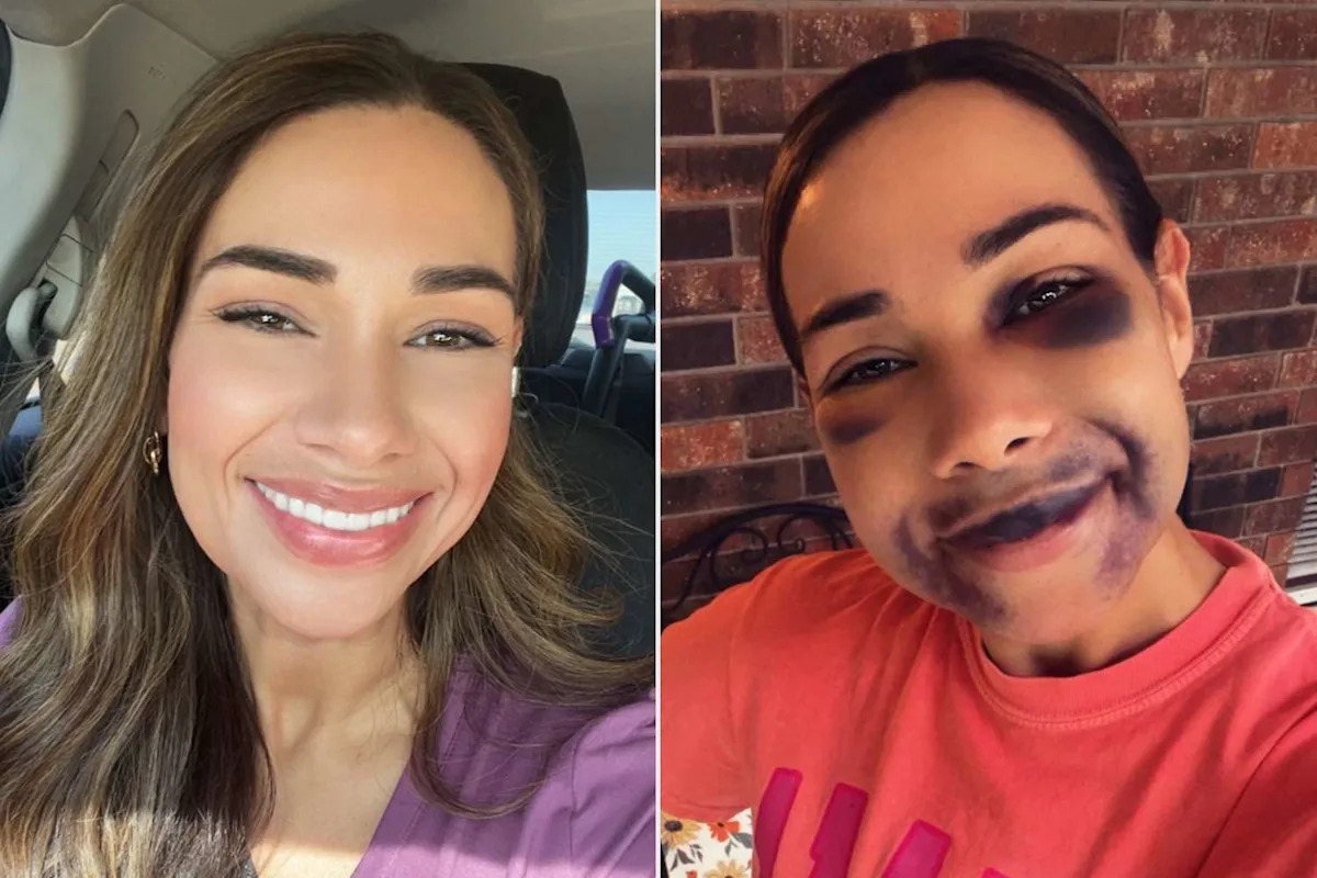 Woman Spends $54K on 'Life-Changing' Dental Implants, but Didn't Expect the 'Scary Looking' Aftermath (Exclusive)