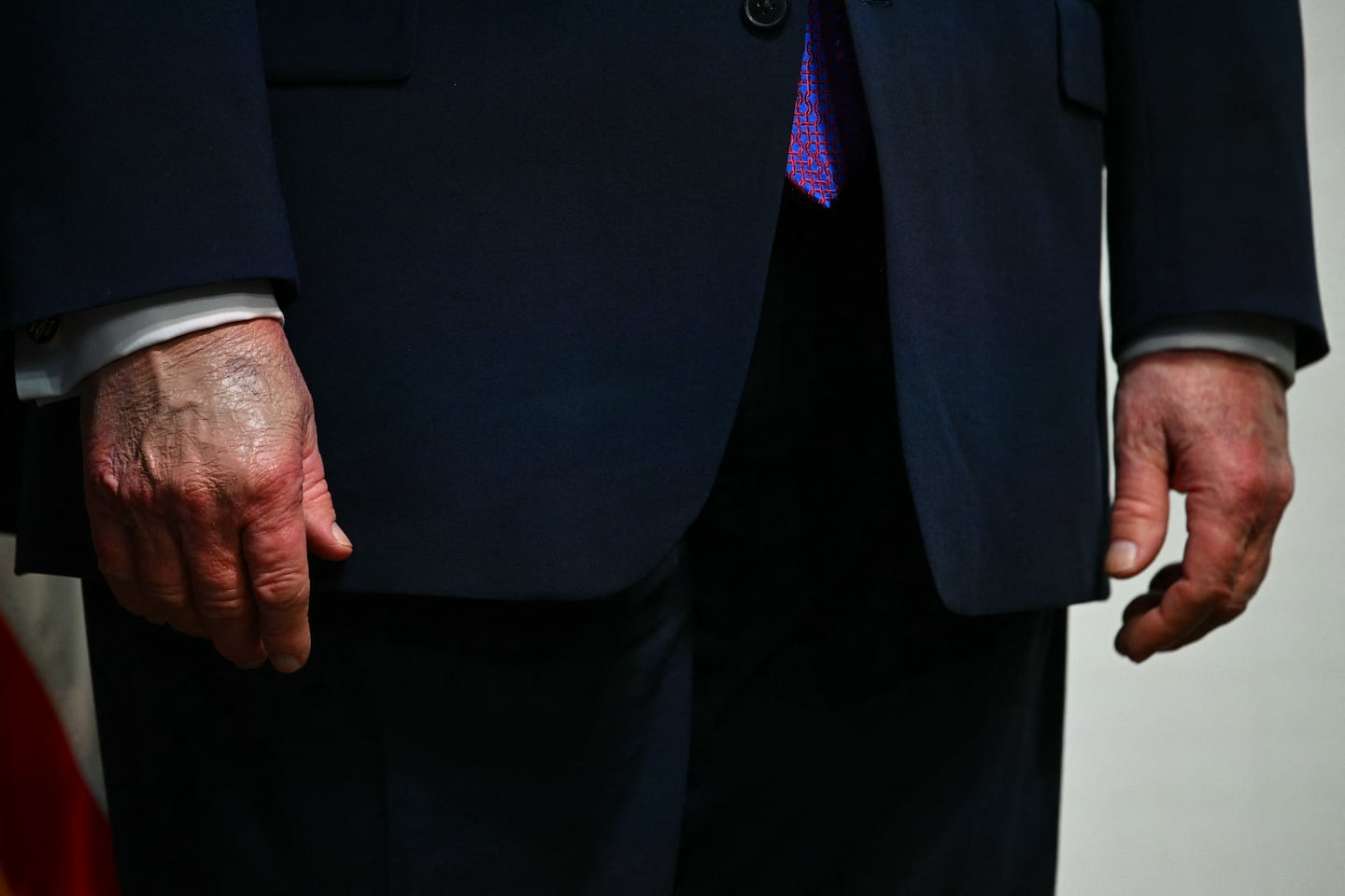 The hands of  President Trump, seen at a healthcare affordability event in the South Court Auditorium of The White House on May 18.