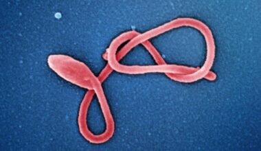 Milwaukee Health Department monitoring 3 for Ebola | News