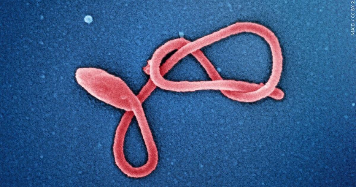 Milwaukee Health Department monitoring 3 for Ebola | News