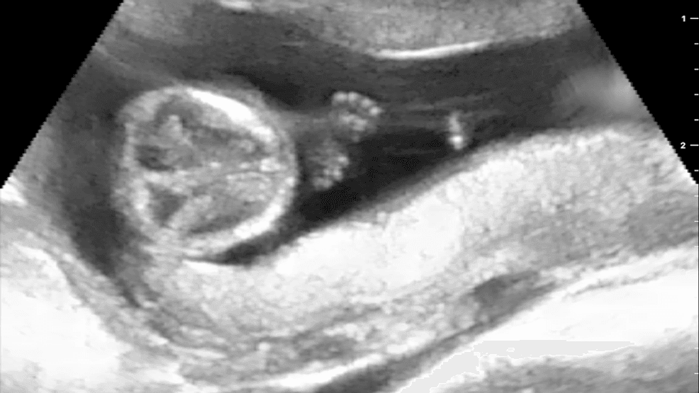 Suzy the mangabey's ultrasound. Photo via the Chattanooga Zoo.