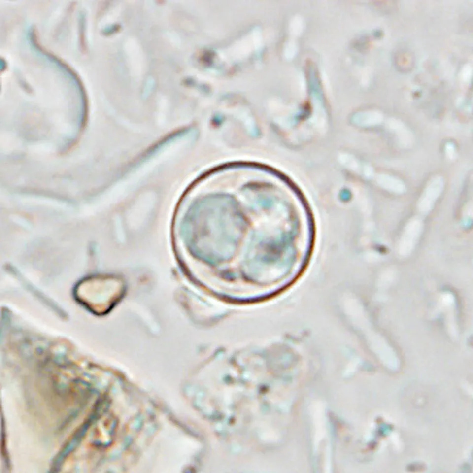 A parasite that causes watery diarrhea has been reported in 145 people across the U.S. this summer, the CDC said (The Centers for Disease Control and Prevention)