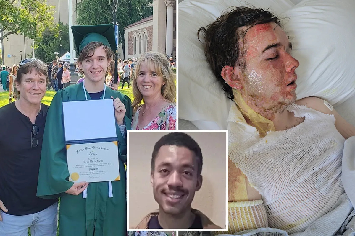 Yuba City McDonald’s boss rushed to ICU with horrific injuries after colleague threw scorching hot oil over him