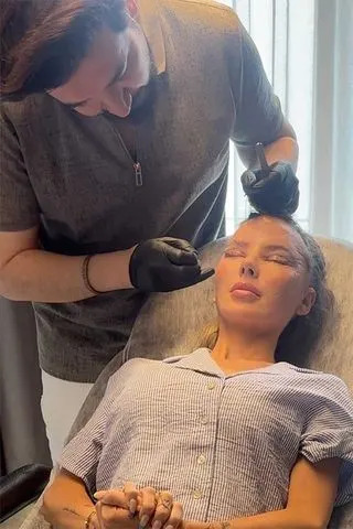 Millie Thompson getting her stitched taken out after undergoing plastic surgeryCredit: Millie Thompson/Instagram