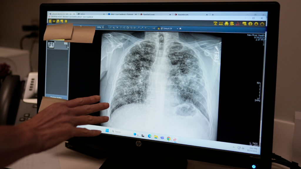 FDA gives generative AI in radiology two breakthrough designation nods
