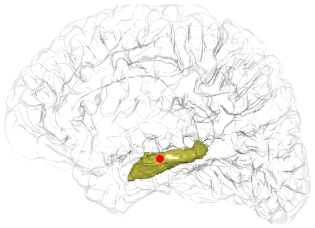 Brain hippocampus