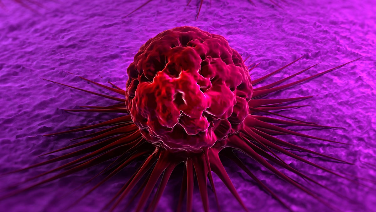 Low Testosterone Is Linked to a Higher Risk of Cancer, Study Finds : ScienceAlert