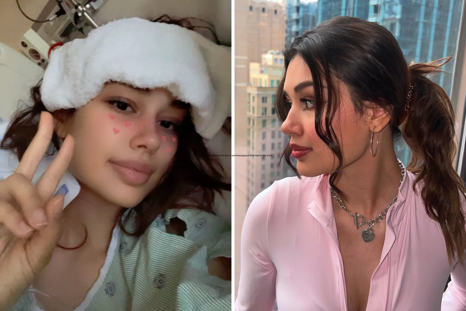 Aptone posing for a selfie while in hospital using a Snapchat filter. A recent photo, a year into her recovery.