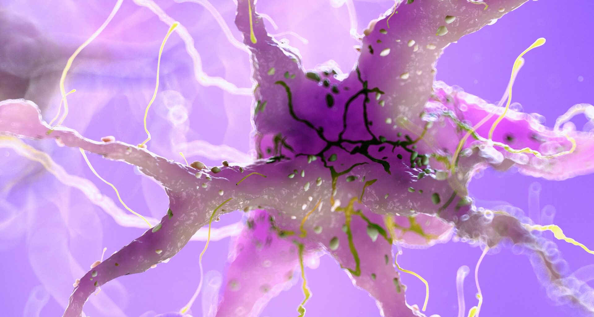 Damaged Neuron Brain Nerve Cell