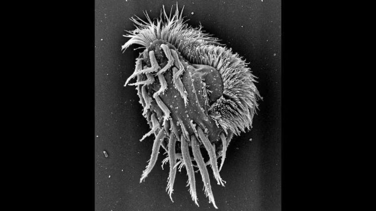 Newly Discovered Microbe Turns Into a Cannibalistic 'Supergiant' : ScienceAlert