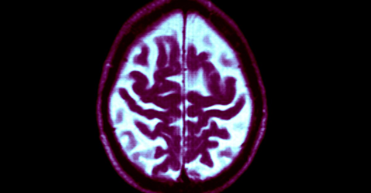 Dementia is rising, but your personal risk is falling