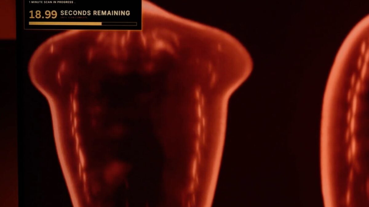 Remember Midjourney? It's Building a Medical Scanning Device That It Says Is Faster Than an MRI