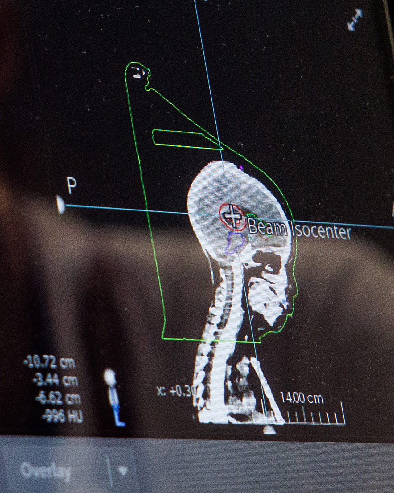 An image of patient Stephen De La Torre, 7, apears...