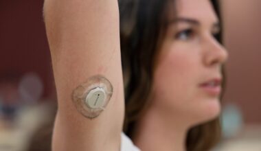 Can wearing a glucose monitor make you healthier? Here’s what happened to UCSD students who did – San Diego Union-Tribune