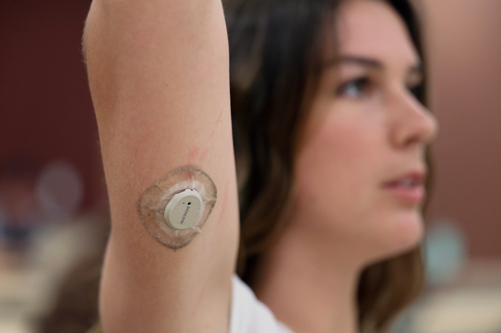 Can wearing a glucose monitor make you healthier? Here’s what happened to UCSD students who did – San Diego Union-Tribune