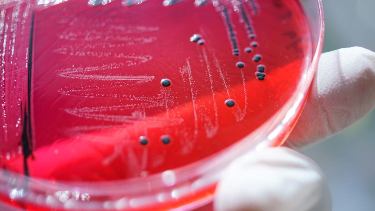 Tainted Food Is Killing Far More People Than Previously Thought, WHO Says