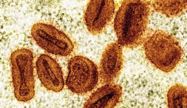 Scientists charged with bringing deactivated mpox virus into US