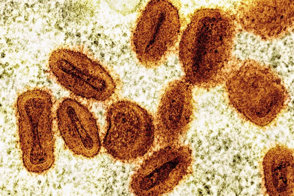 Scientists charged with bringing deactivated mpox virus into US