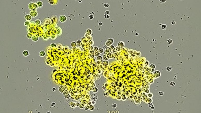 Small Cell Neuroendocrine Prostate Cancer