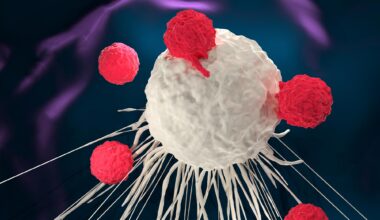 T Cell Therapy Attacking Cancer