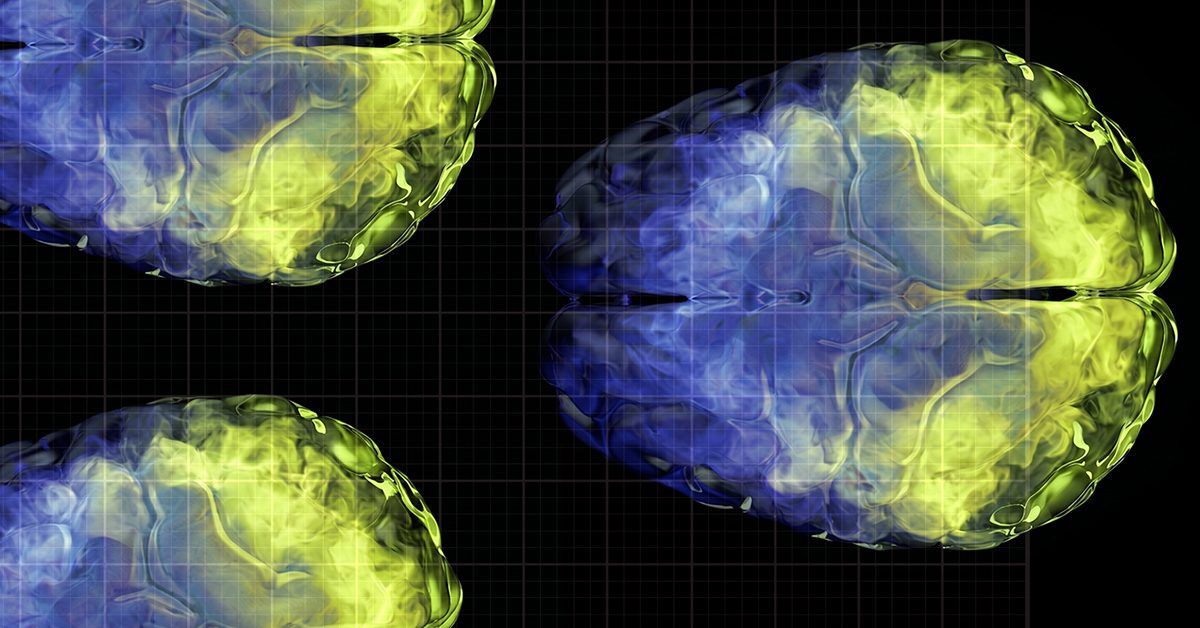 Aging brain health: Vitamin C levels linked to gray matter volume