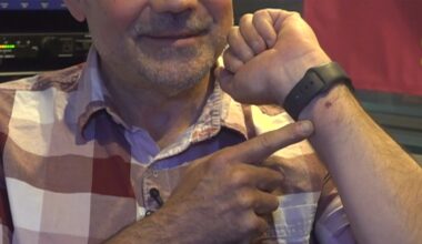 Tick bite ER visits rise as patients question testing costs