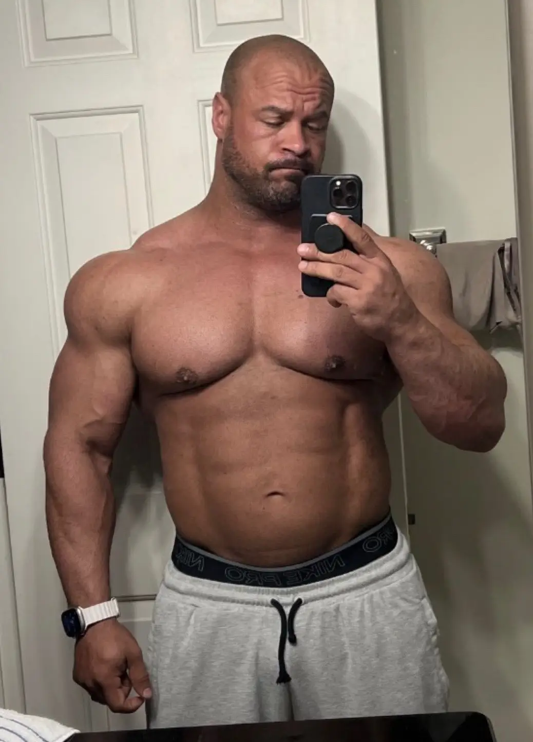 The picture before the weight loss (X/@ChaseIrons)