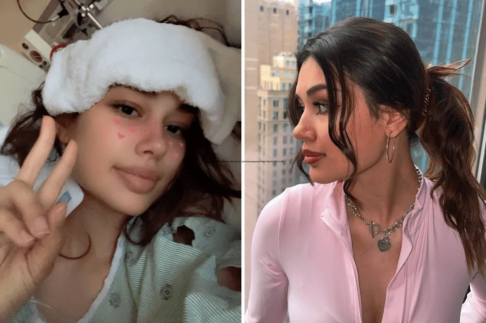 Aptone posing for a selfie while in hospital using a Snapchat filter. A recent photo, a year into her recovery.