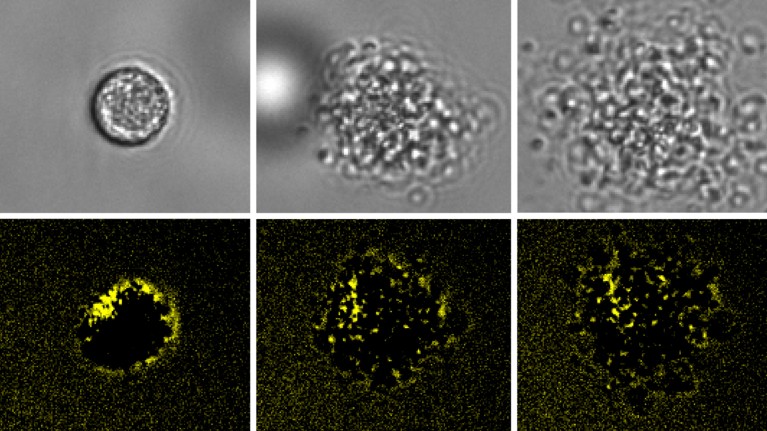Six microscopy images showing a cell degrading over time. The top row contains three grayscale images, starting with a smooth, intact round cell on the left, followed by progressively more irregular and broken-up cellular structures in the middle and right images, and the bottom row shows the same but in black and fluorescent yellow colours