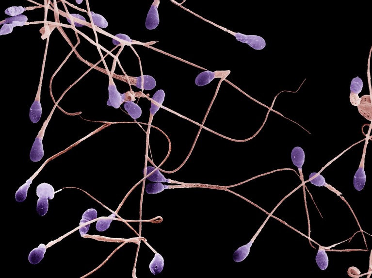 Coloured scanning electron micrograph of pink and purple human sperm cells on a black background