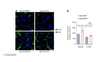 How long-term dietary cholesterol can slow down its own clearance by liver cells