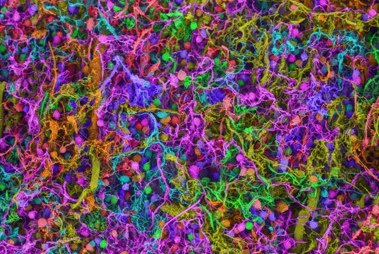 Scanning electron micrograph (SEM) of human brain cells, depicting a complex, intertwined network resembling multicolored spherical structures connected by filament-like strands.