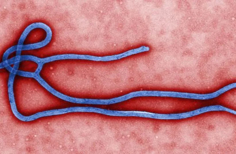 A colorized transmission electron micrograph (TEM) reveals some of the ultrastructural morphology displayed by an Ebola virus virion (credit: CDC/CYNTHIA GOLDSMITH)