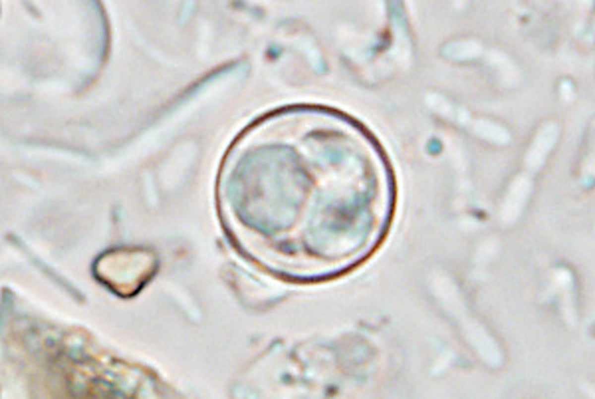 Parasite that causes ‘explosive diarrhea’ is spreading across the US