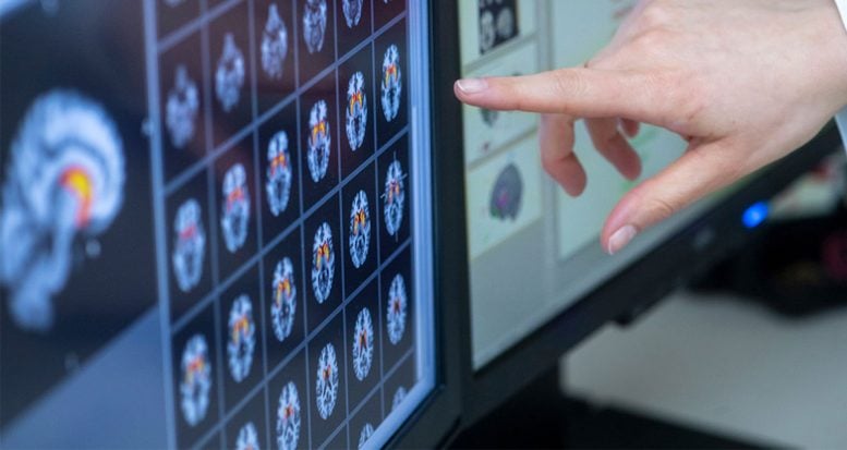 fMRI Brain Scans