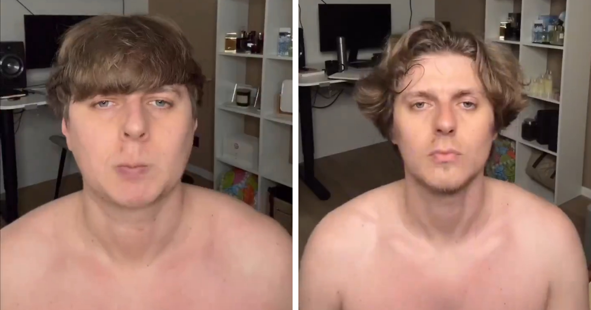 Man Reveals Dramatic 80-Day Transformation After Daily Jaw Exercises