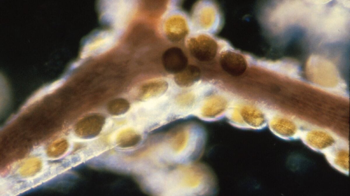 These Seafood Toxins Survive Cooking—and They're Fueling Foodborne Outbreaks