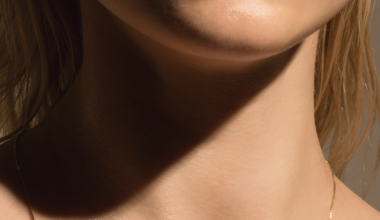 New Neck Treatments for Wrinkles: Everything to Know in 2026