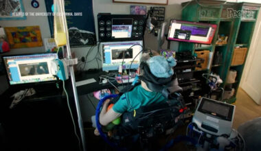 ALS Patient, 47, Gains Ability to Speak and Sustain Full-Time Job Using Experimental Brain-Computer Interface