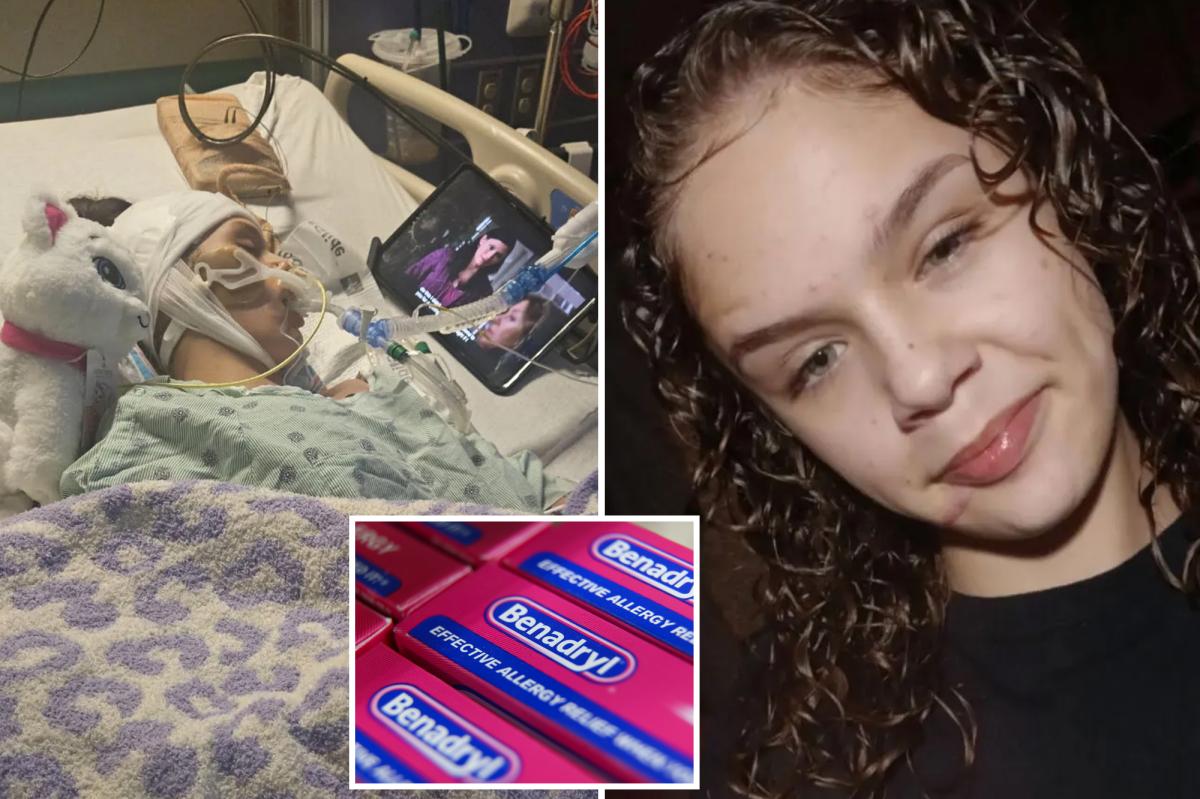 'Benadryl Challenge' leaves Oklahoma girl brain dead