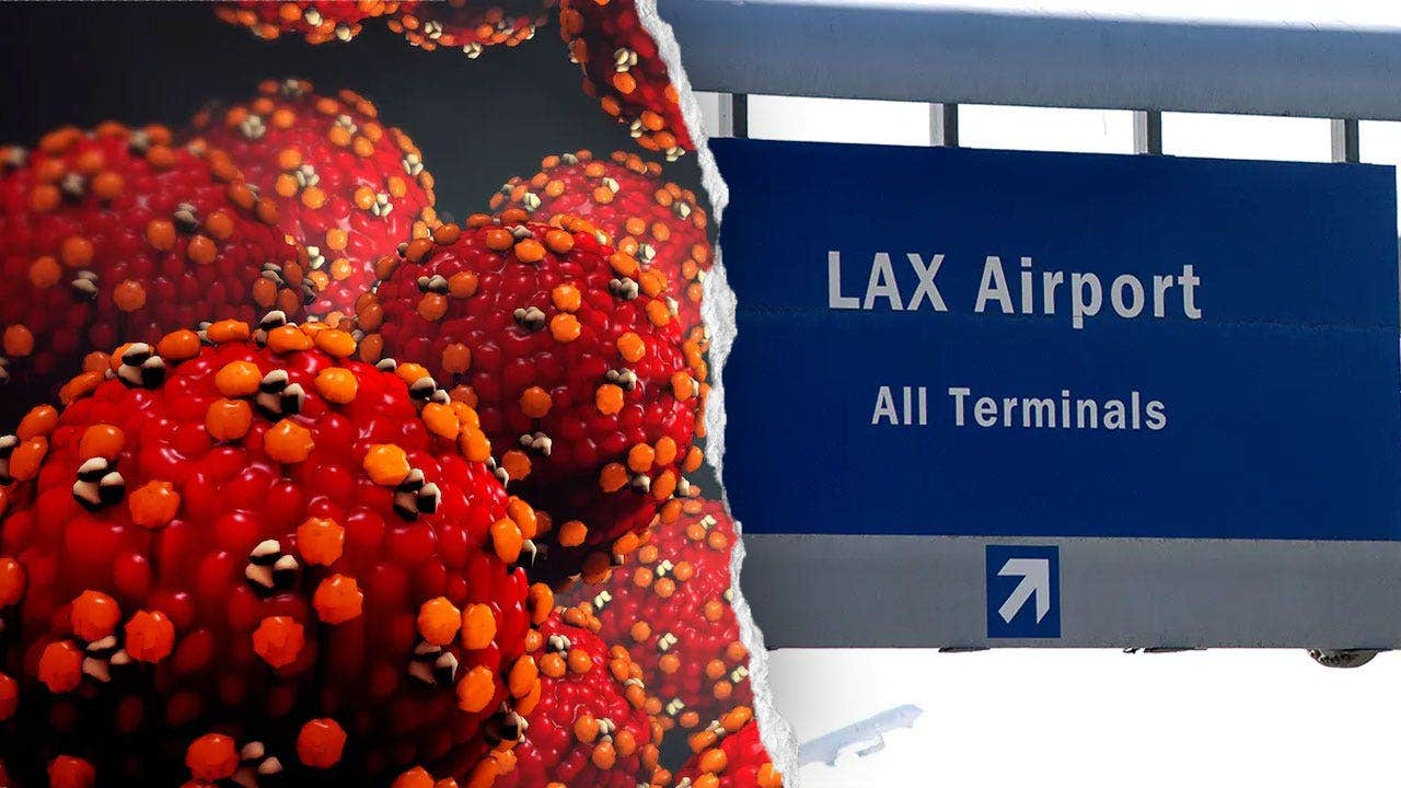 Measles exposure reported at LAX, nearby Hilton hotel after June flight