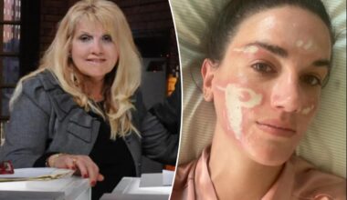 Celeb esthetician loses license after client says she was left ‘permanently scarred’