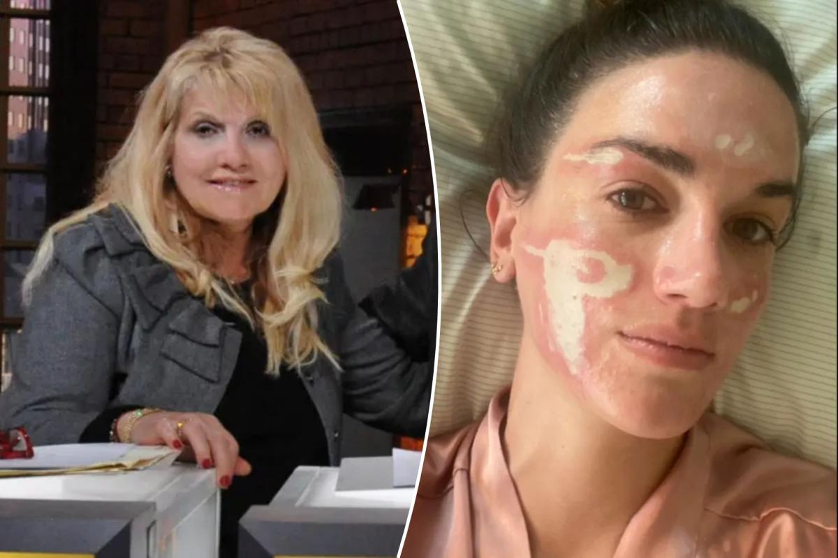 Celeb esthetician loses license after client says she was left ‘permanently scarred’