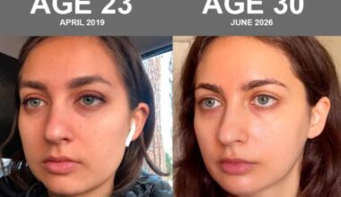 Bryan Johnson's girlfriend reveals extreme skin biohacking routine