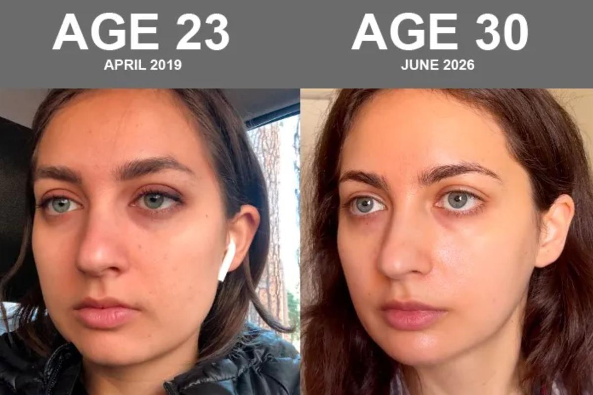 Bryan Johnson's girlfriend reveals extreme skin biohacking routine