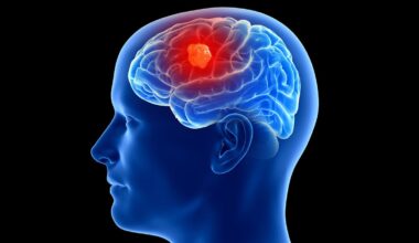 3 People Have Gotten Cancer-Detecting Implants in Their Brains